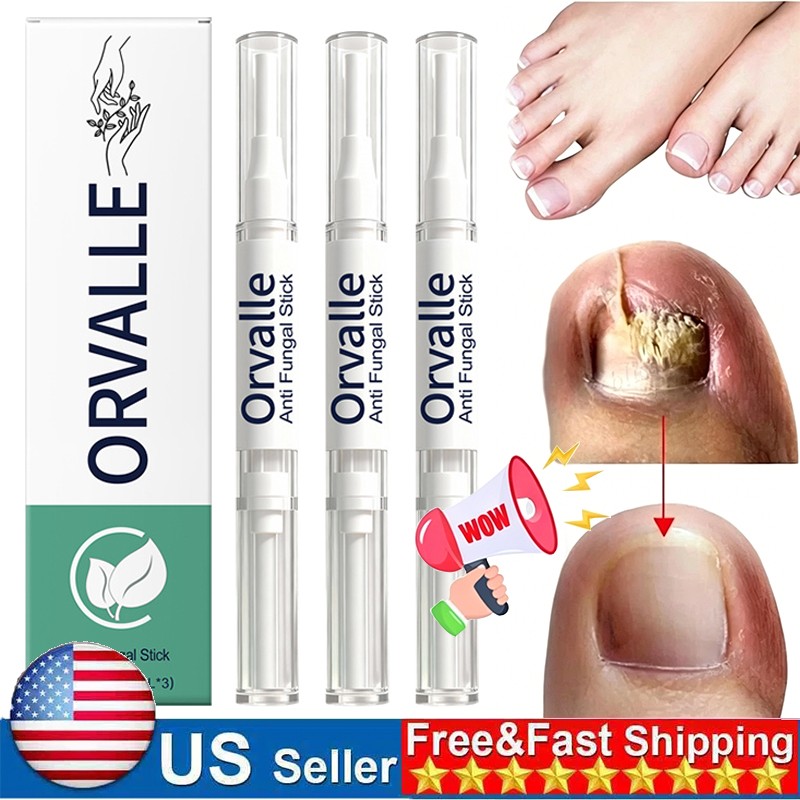 Orville Nail Fungus Pen Anti Fungus Infection Nail Care Repair Pen Toenail