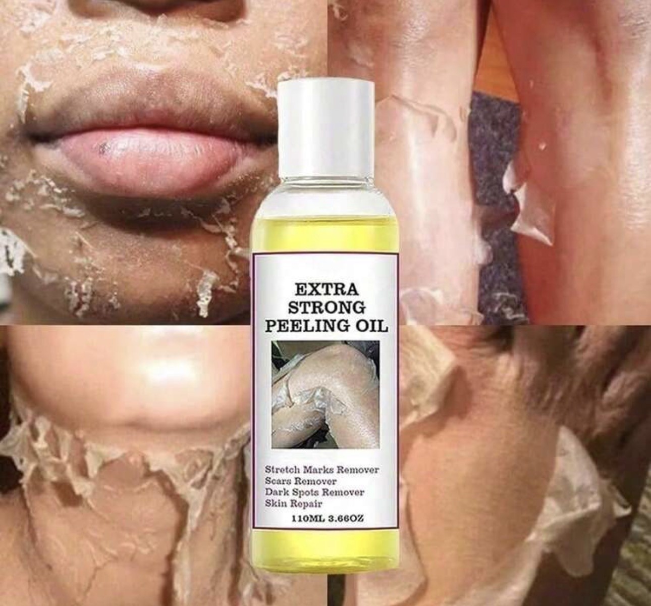 Extra Strong Peeling Oil Body Skin Brightening Exfoliating Peel Off Remover110ml