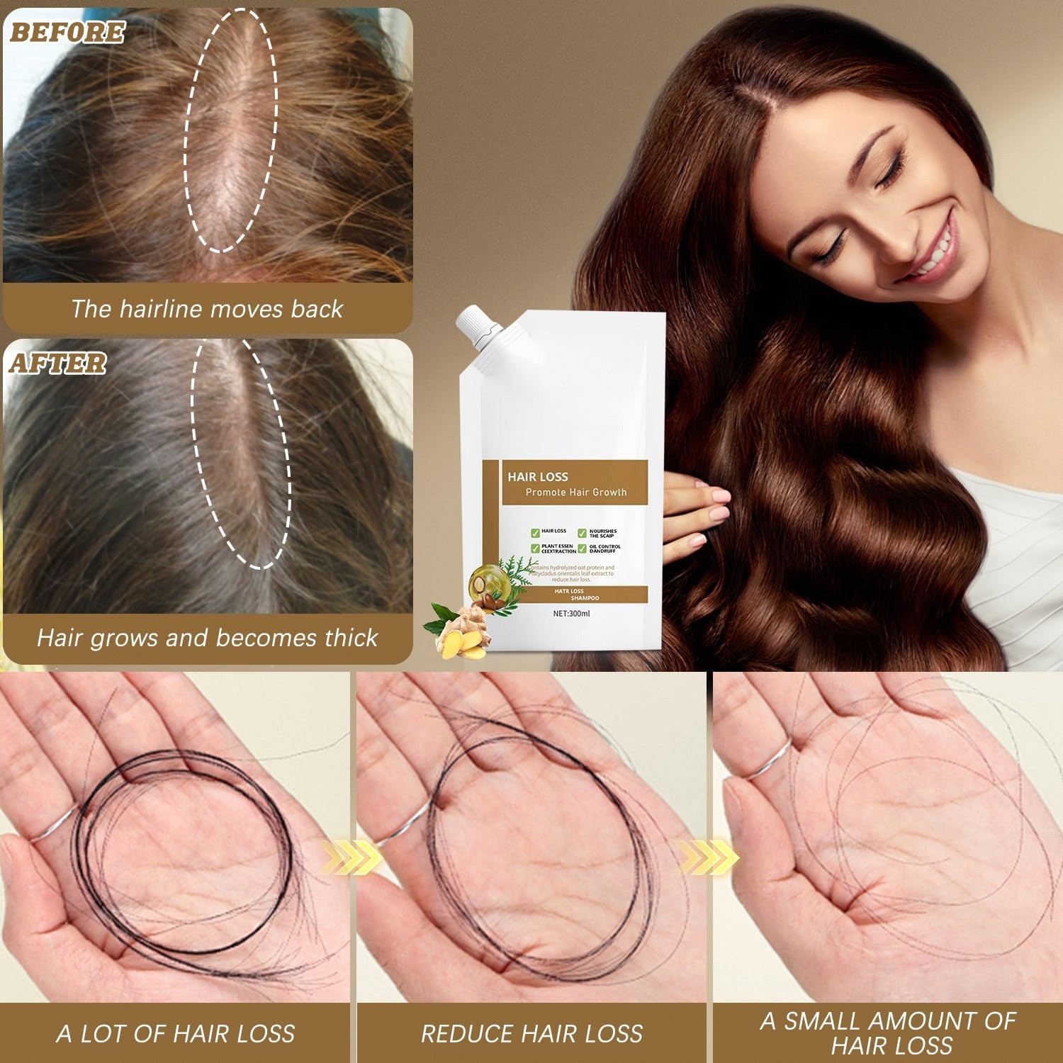 300ml Anti Hair Loss Shampoo Hair Growth Plant Extracts All Hair Types
