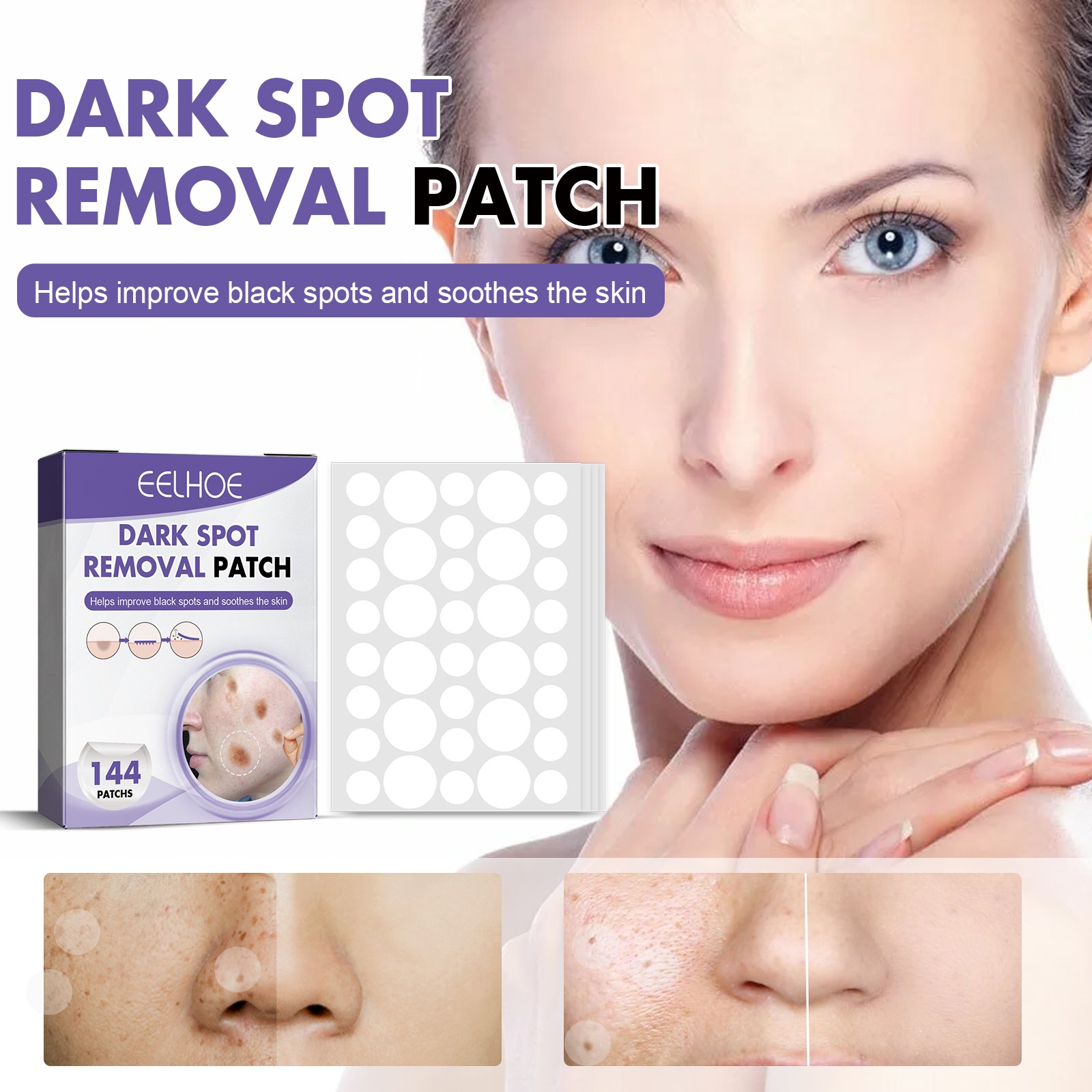 Dark Spot Removal Patch, Lightening Face Dark Spots Melasma Spots Melanin Moistu