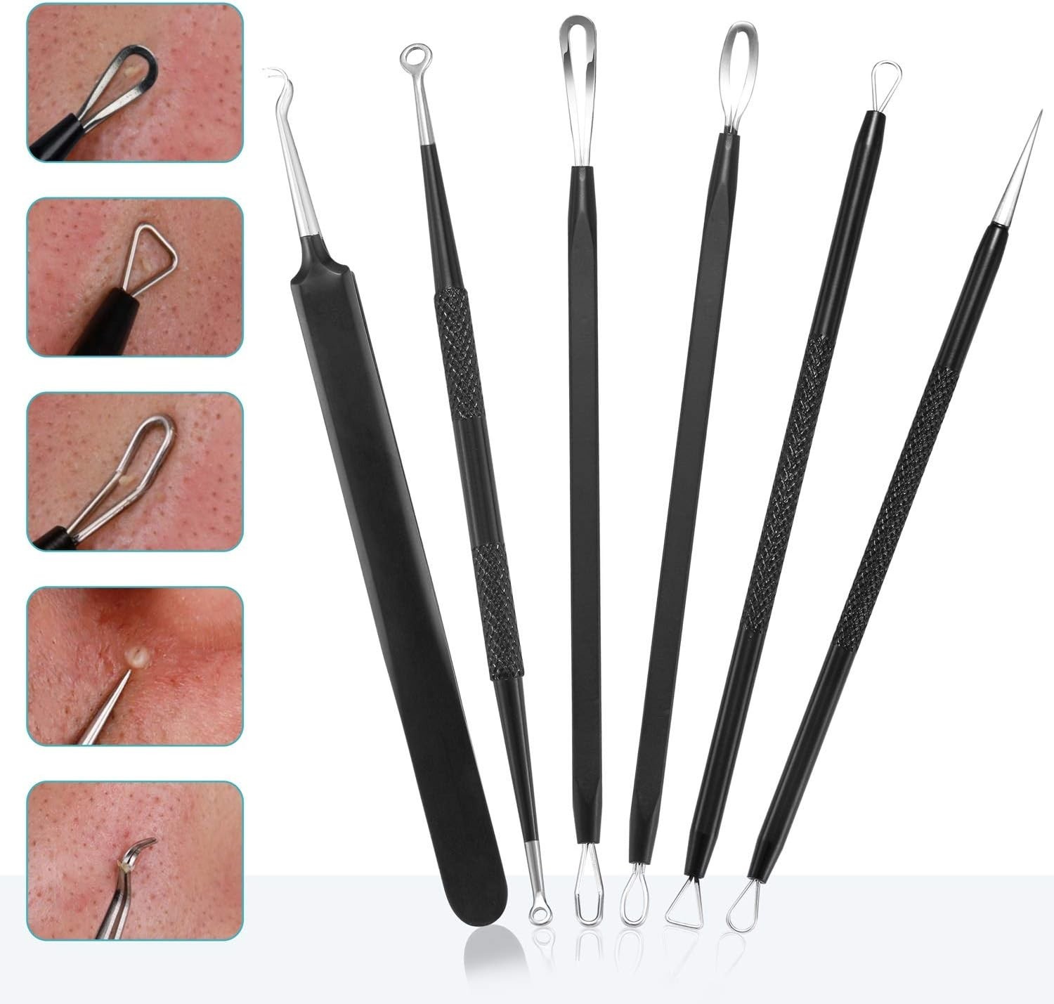 Complete Blackhead Removal Tool Set: 6 Stainless Steel Extractors in Travel Case