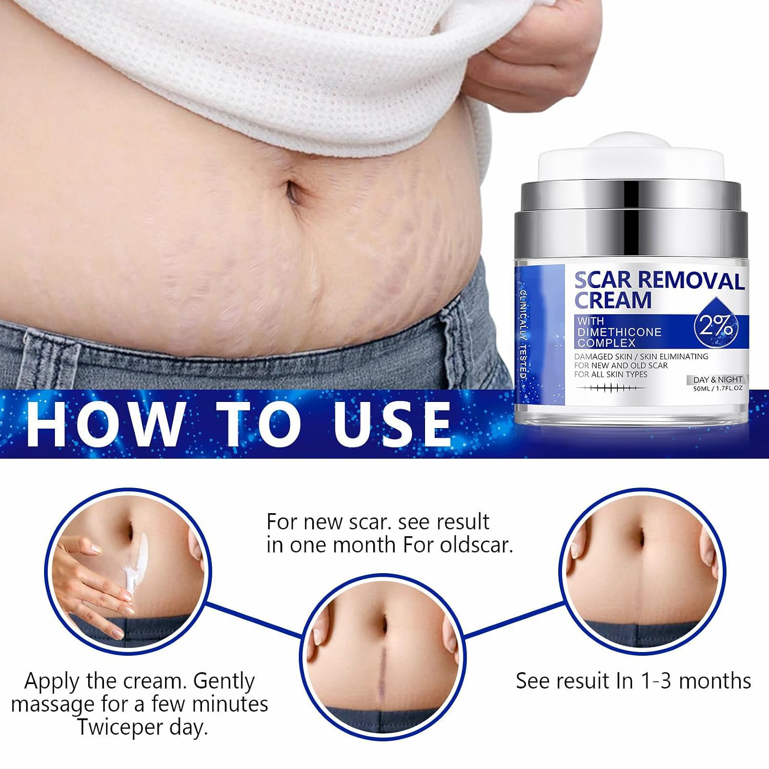 Scar Cream, Scar Removal Cream – Advanced Scar Cream for Surgical Scars, Acne Sc