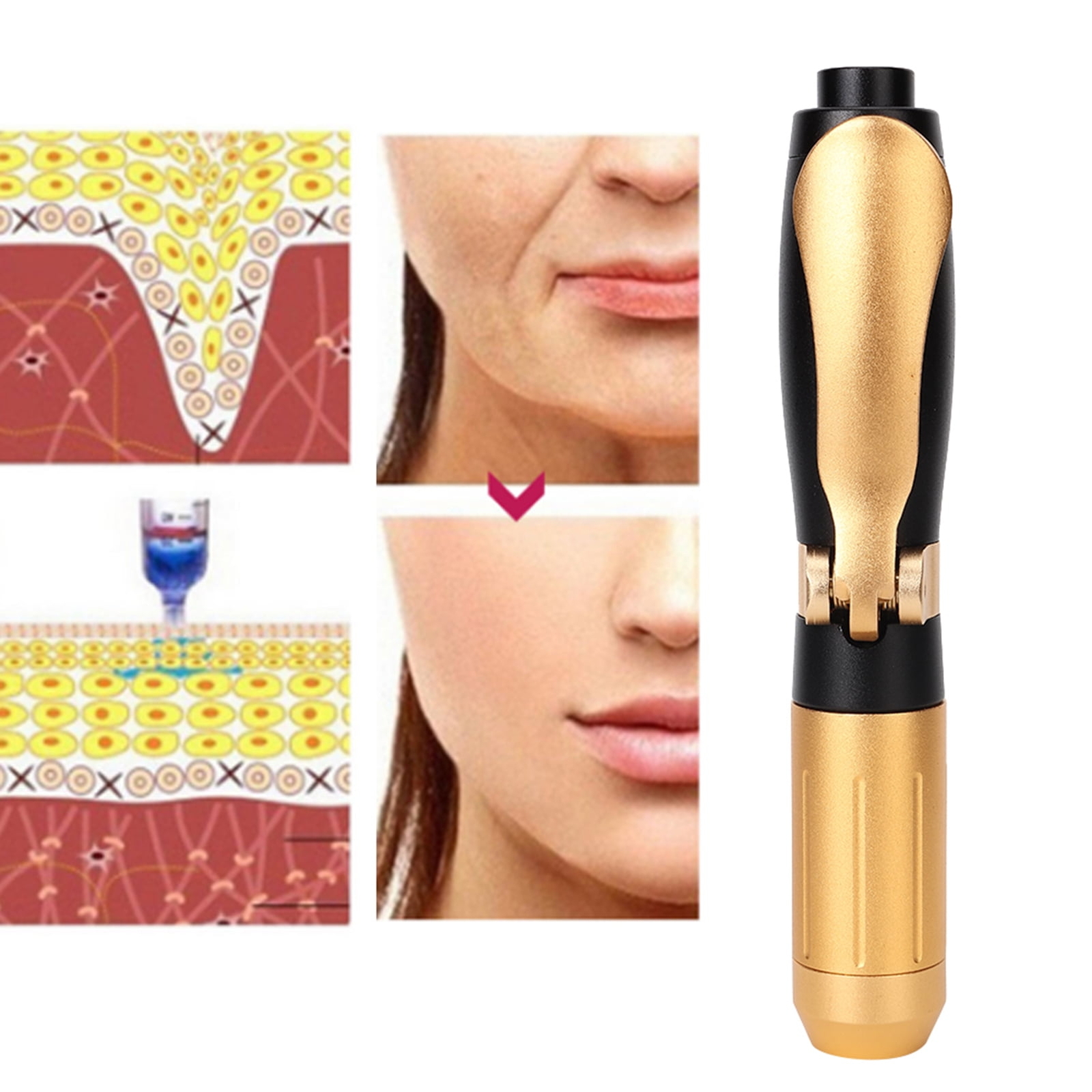 Revitalize Skin with Hyaluronic Beauty Sprayer Needleless Injection Atomizer