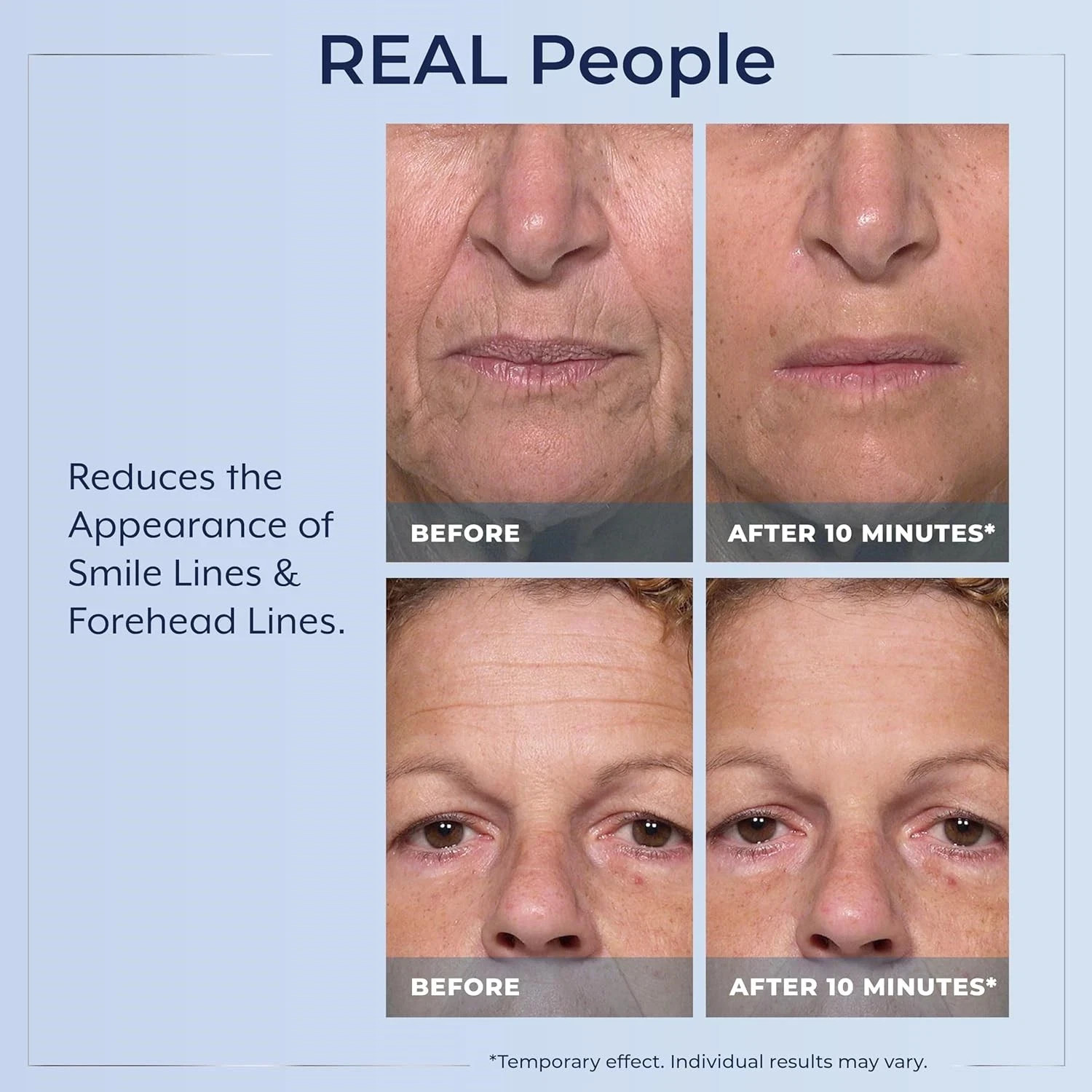 Rapid Reduction Eye Serum – Visibly Reduces Under-Eye Bags, Wrinkles, Dark Circl