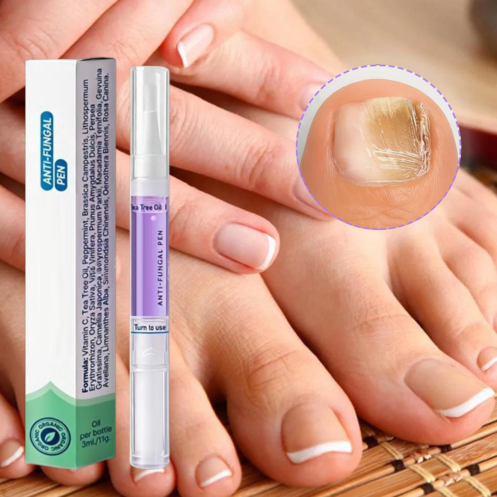 Orivelle Swissclear Fungus Pen suitable for Treatment Fingernails and Toenails A