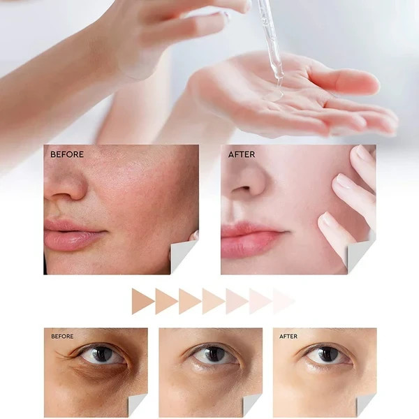 Evagloss Dark Spot Serum with Kojic Acid Face Brightening Corrector 30ml
