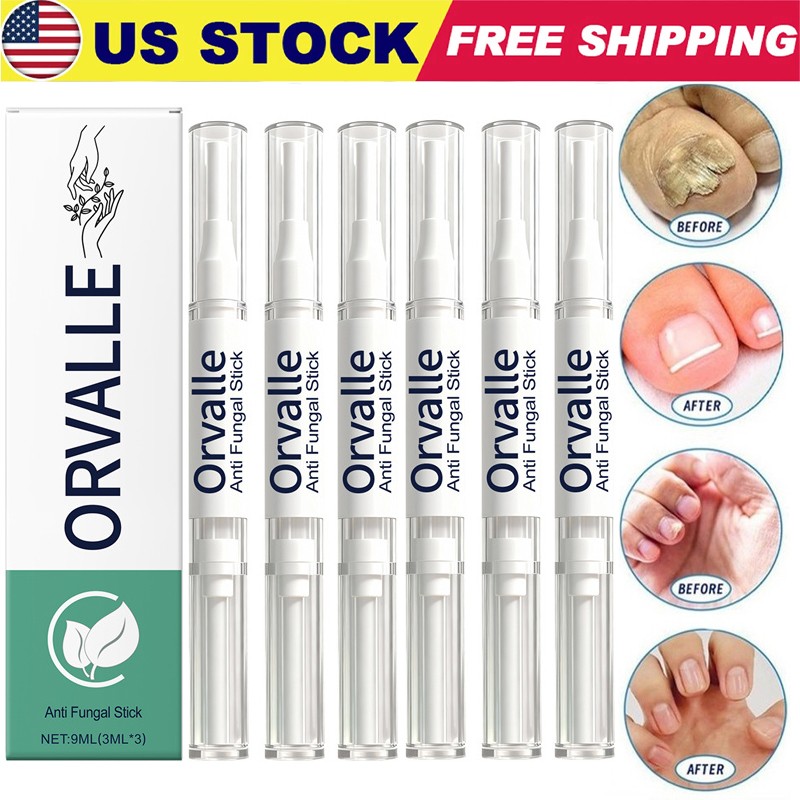 3-15X Orville Nail Fungus Pen Anti Fungus Infection Nail Care Repair Pen Toenail