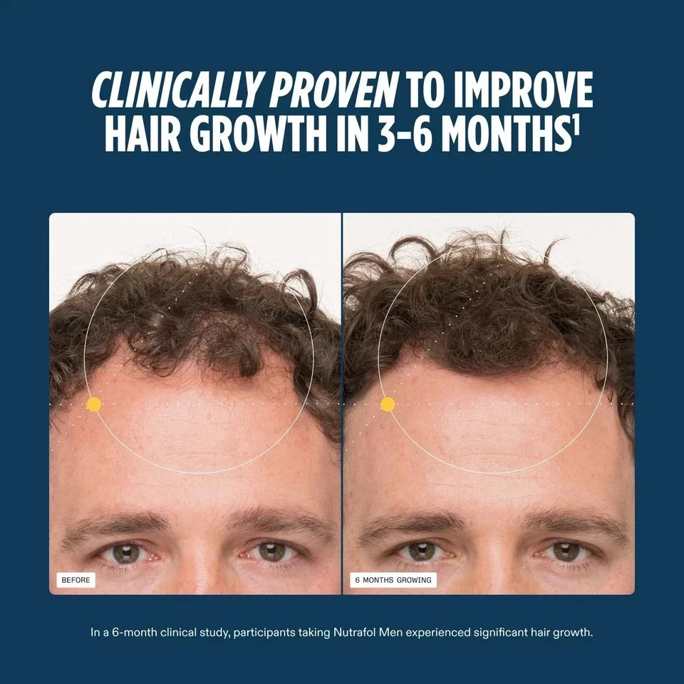 Packof 3 Men Hair Growth Vitamins Total 360 Capsules Exp 06/2027 Ship From USA