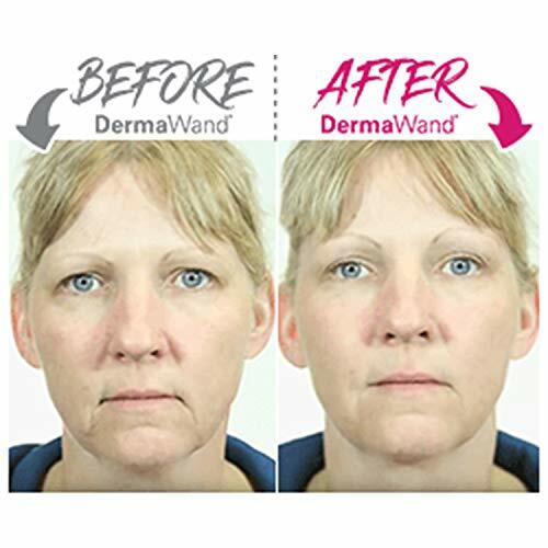 DermaWand PRO Newest Model – Factory Refurbished – 1 Year Warranty – See Images