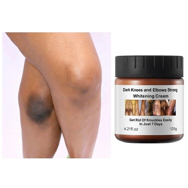 New Strong Whitening Cream For Removing Dark Knuckle Finger Elbow and Knee