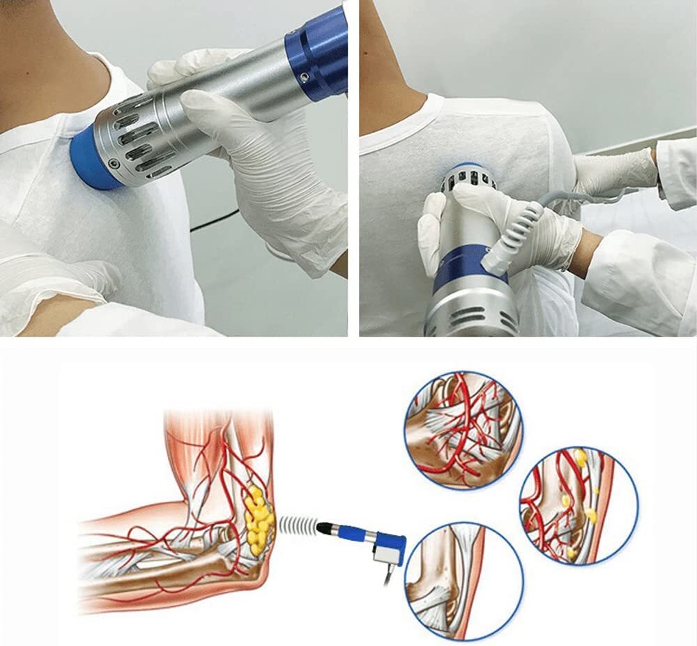 Focused Shock Wave Therapy Machine ED Full Body Muscle Relief & Bone Strength US