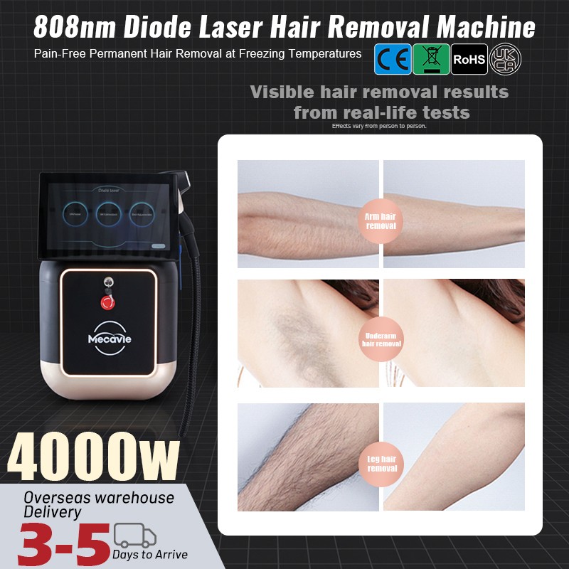 Professional Ice Titanium Diode Laser Hair Removal 60M Shots Permanent Epilator