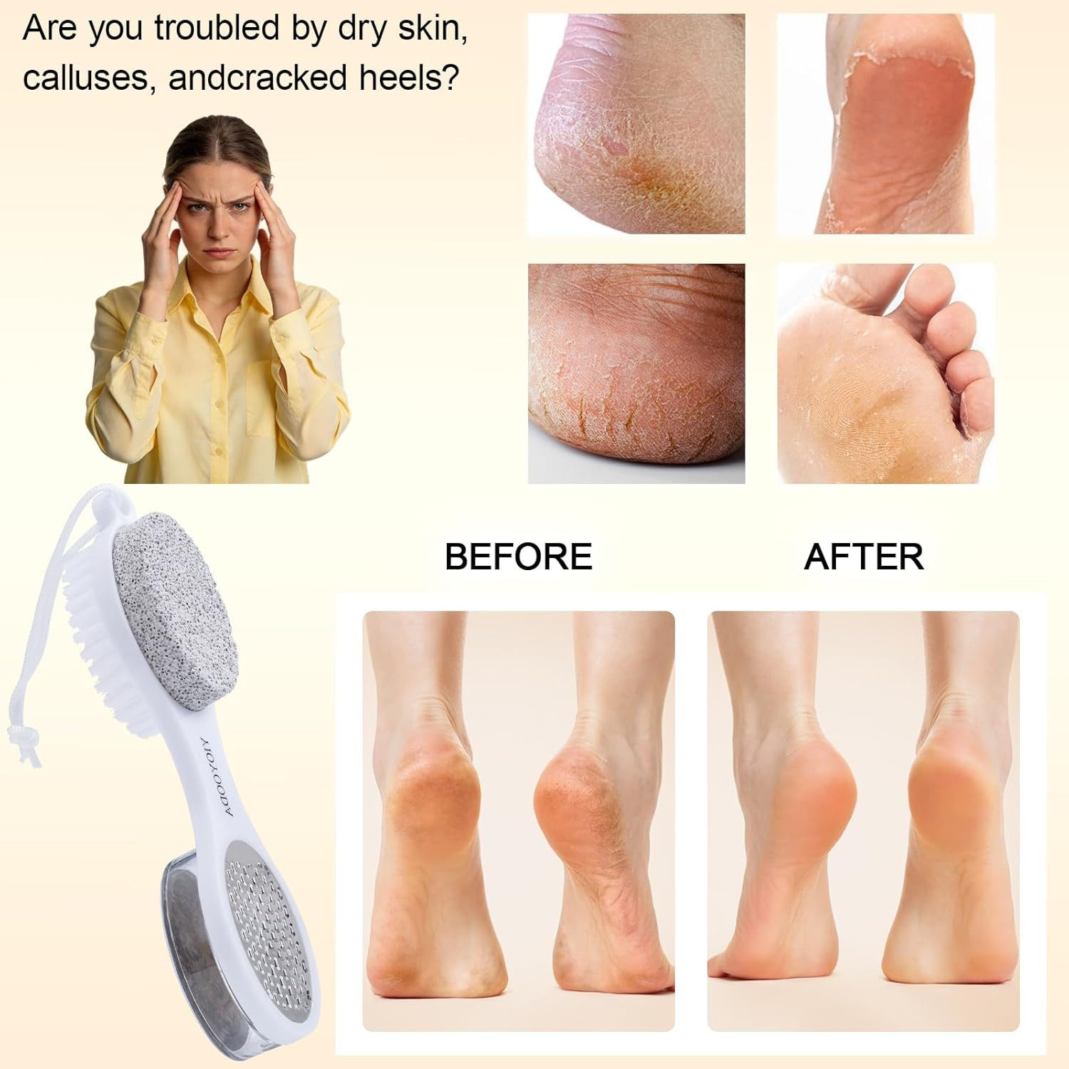 Foot Scrubber Brush with Pumice Stone for Feet 5-In-1, 2Pcs Foot File Callus Rem