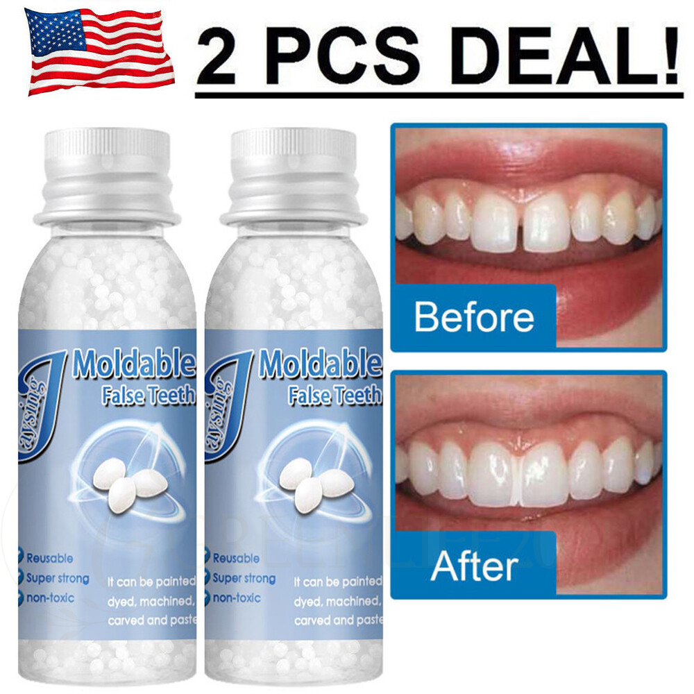 2PCS Tooth Repair Beads Granules,Temporary Moldable Dental Pellets, False Teeth