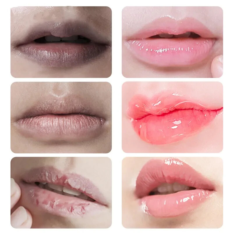 New Pink Fresh Lightening Lips Bleaching Cream Treatment Remove Dark Smoke Lips.