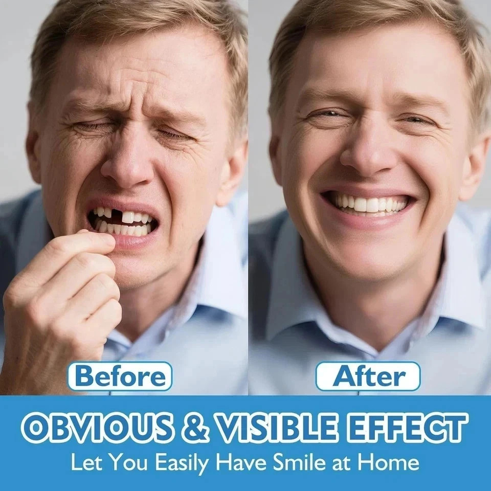 Moldable False Teeth, Veneers Teeth for Women and Men, Upper and Lower Matchi US