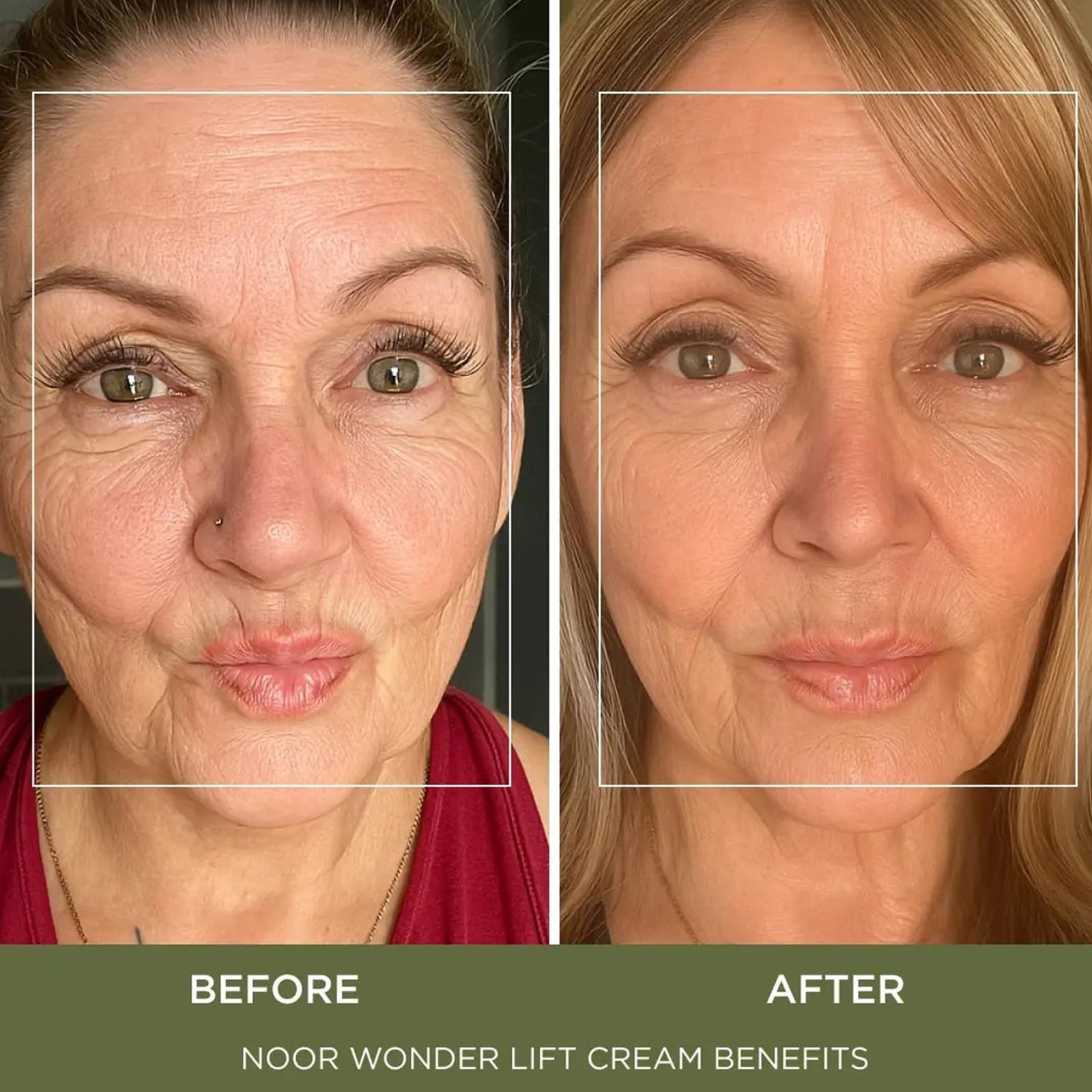 Noor Wonder Lift Cream For Women Natural Anti-Aging Wrinkle Treatment
