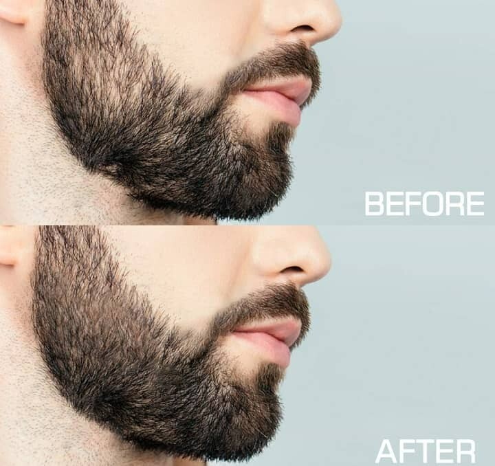 Beard Derma Roller thicker fuller Beard Growth faster beard growth Micro Needle