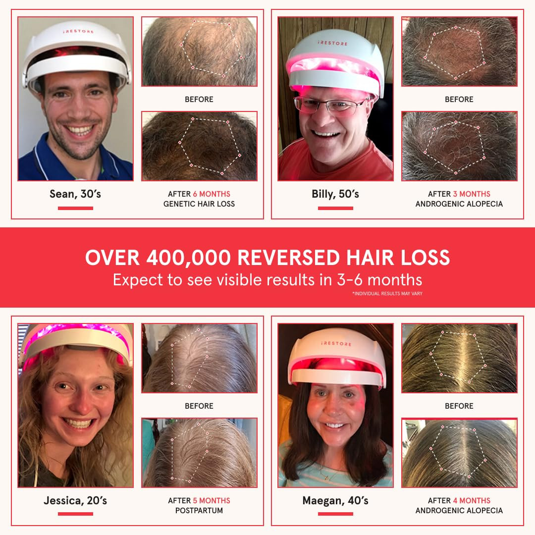 Irestore Essential – Laser Red Light Therapy for Hair Growth – FDA Cleared Hair