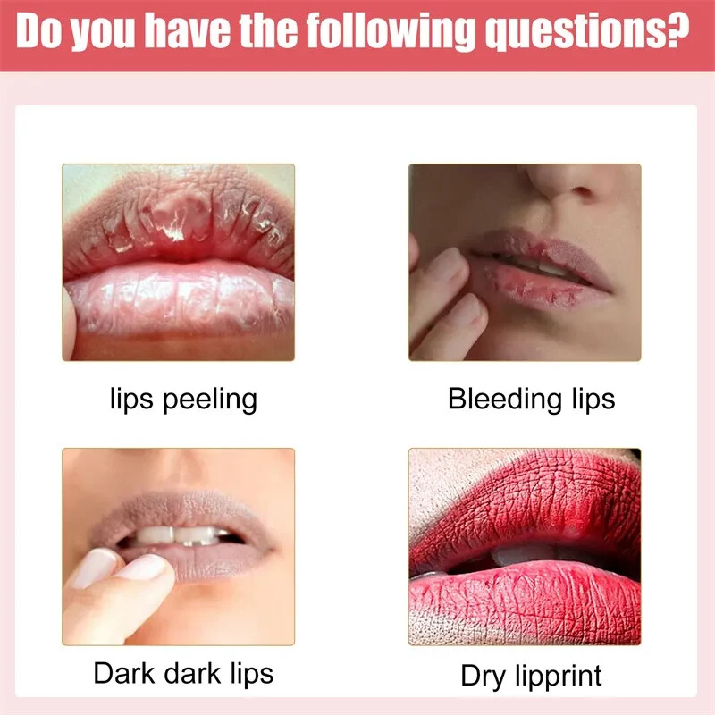 New Pink Fresh Lightening Lips Bleaching Cream Treatment Remove Dark Smoke Lips.