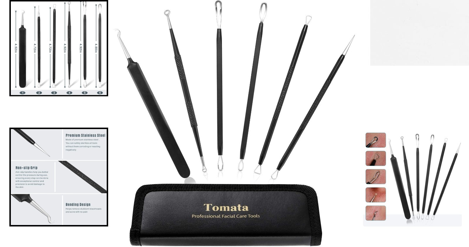 Complete Blackhead Removal Tool Set: 6 Stainless Steel Extractors in Travel Case
