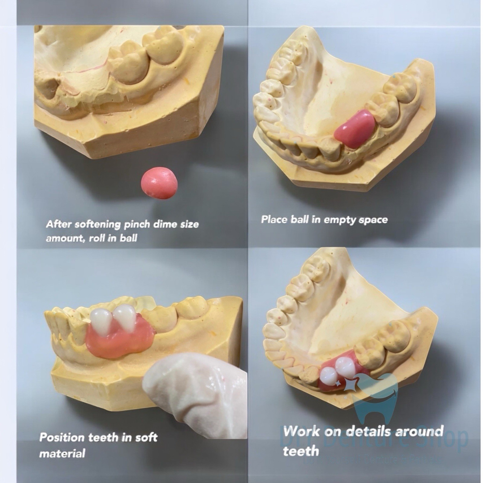 DIY Denture Kit Make Your Own Teeth At Home Complete Kit Full Partial A1 A2 A3