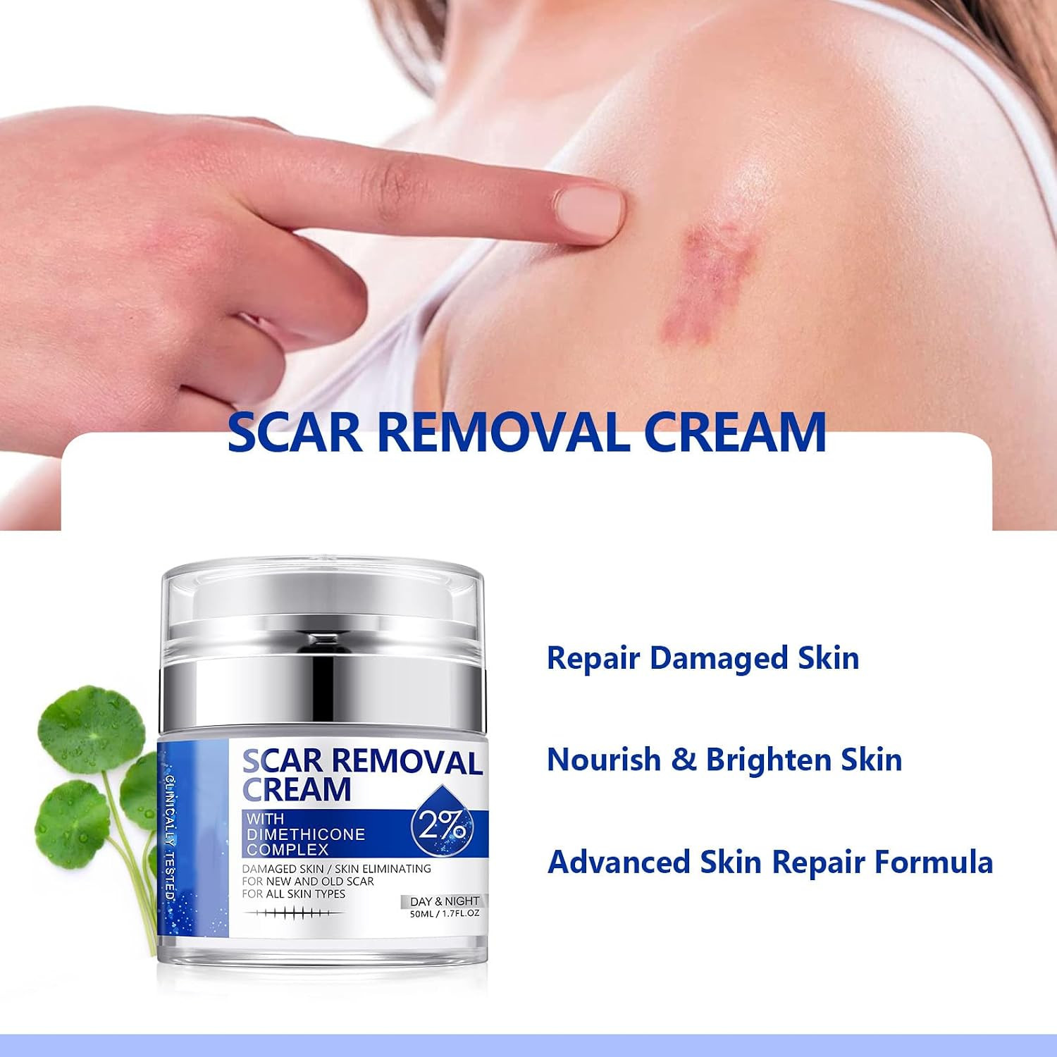 Scar Cream, Scar Removal Cream – Advanced Scar Cream for Surgical Scars, Acne Sc