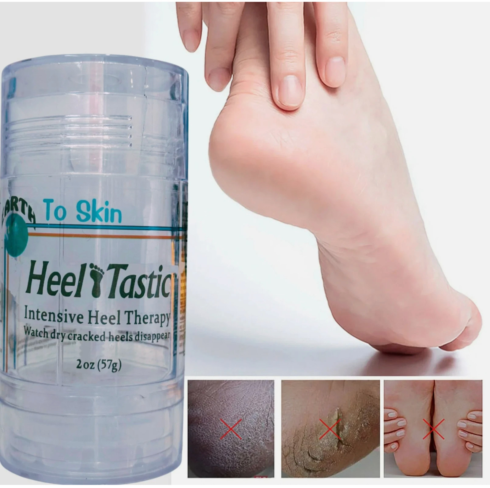Heel Tastic Intensive Heel Therapy, Foot Care 2oz, FAST FREE SHIPPING