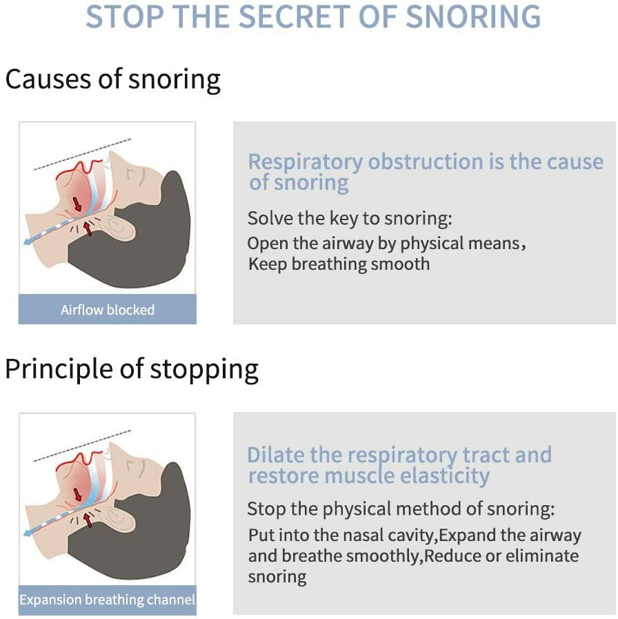 4PCS Anti Snore Nose Clip Stop Snoring Stopper Device Sleep Aids Cones Vent