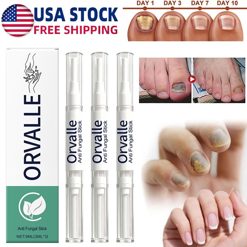 3PCS Orville Nail Fungus Pen Anti Fungus Infection Nail Care Repair Pen Toenail