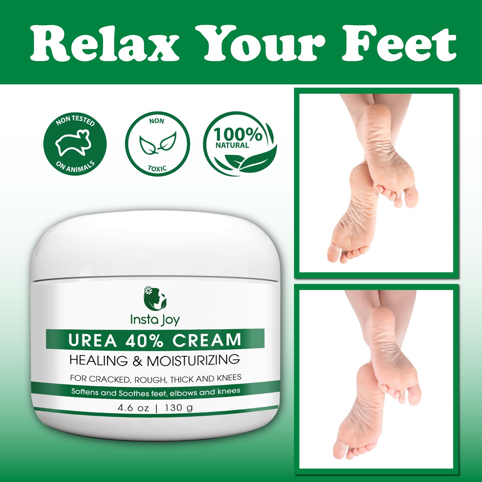 40% Urea Cream For Exfoliate Dry Foot & Hand, Dead Skin Remover, Moisturizer