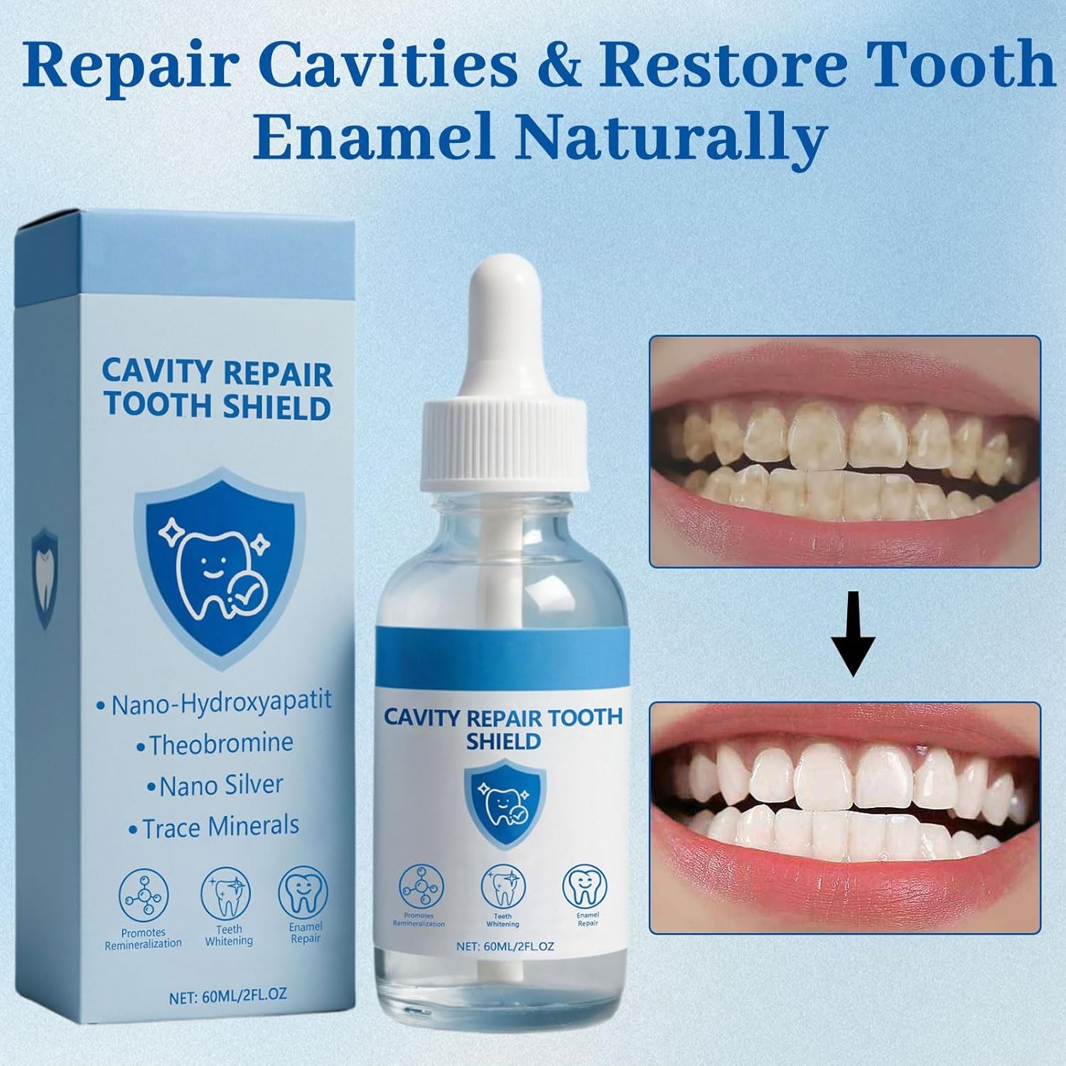 Cavity Healing Tooth Shield Liquid,Repair Cavities & Restore Tooth Enamel 2FL.OZ