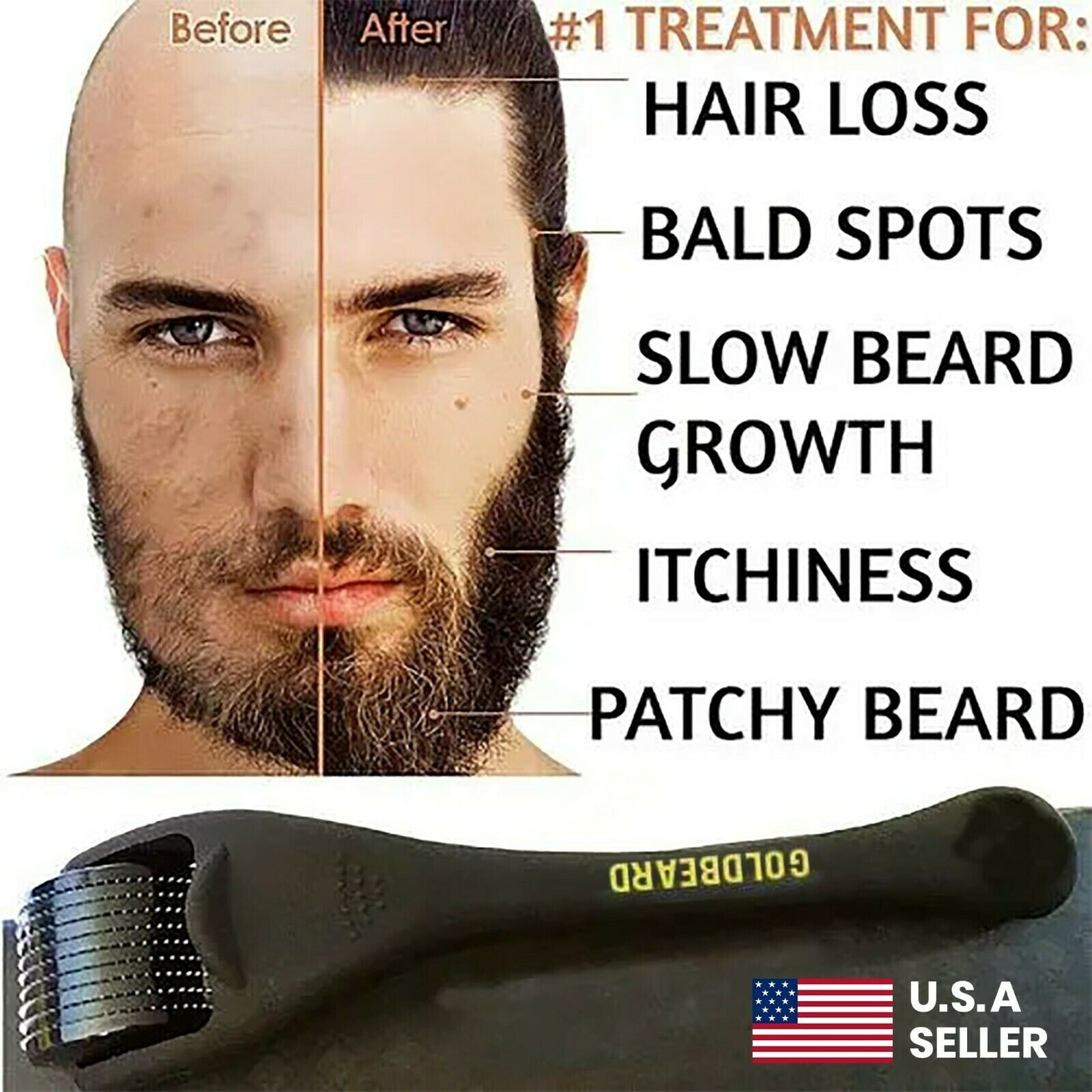 Beard Derma Roller thicker fuller Beard Growth faster beard growth Micro Needle