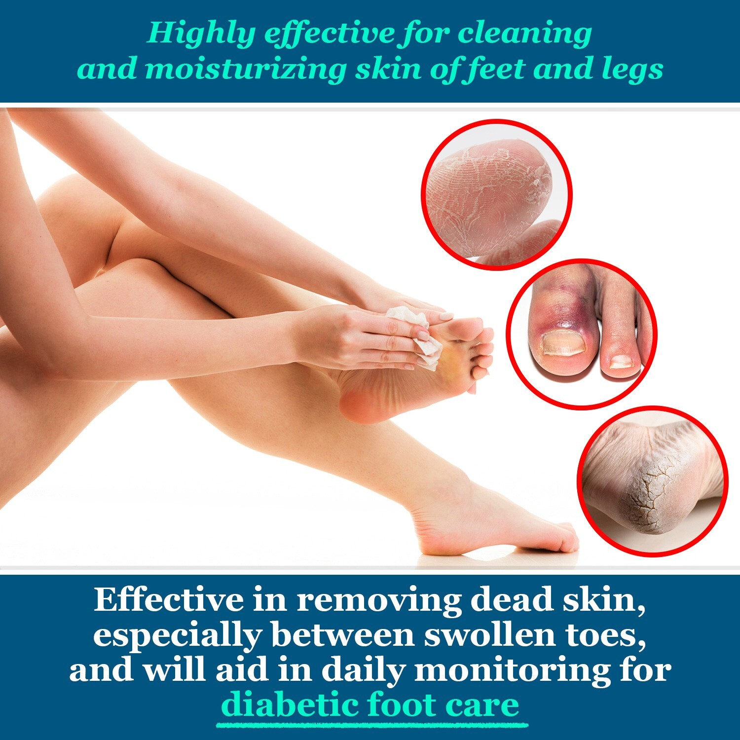 pHeet Wipes, Antifungal, Odor Reducer, Dry Feet Moisturizing Wipes, Foot Cleaner