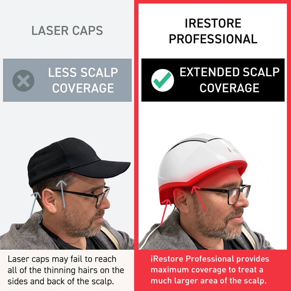iRESTORE Professional 282 Laser Hair Growth System – Reconditioned