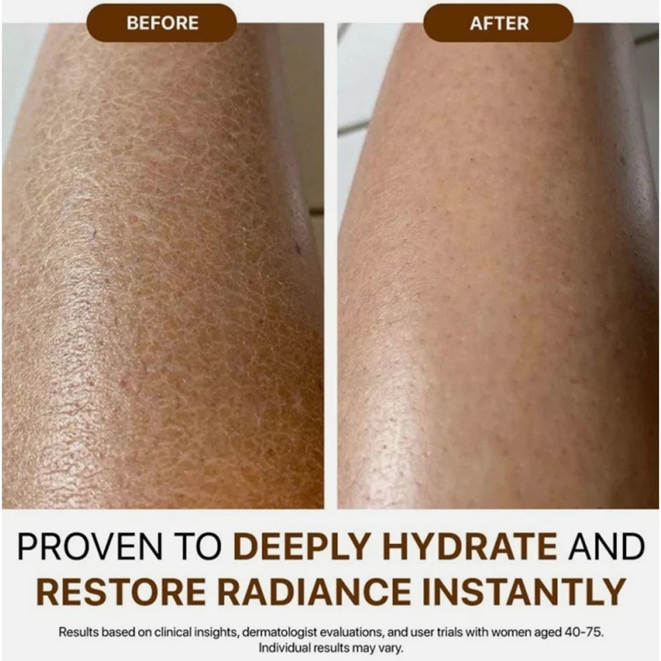 Anti-Aging Body Oil Skin Firming Moisturizing Tightening Thigh, Arms – Pack of 5