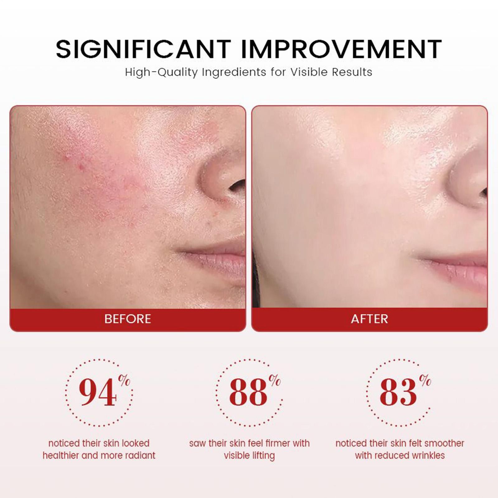 Koriderm Time Reverse Cream, Koriderm Cream for Face for All Skin Types-50ml