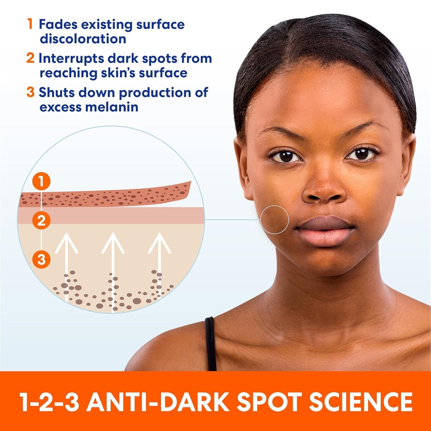Age Spot Remover Face Body, Hands, Neck. Dark Spot Corrector Cream