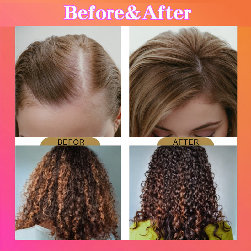 Batana Oil For Hair Growth Hair Loss Treatment Pure Natural Botana Oil Cream US