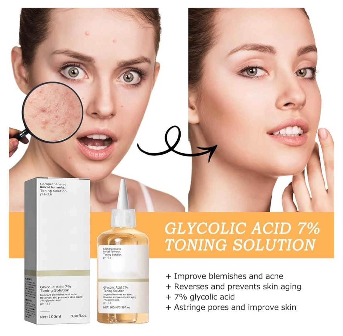 Glycolic Acid 7% Toning Solution Reverses Skin Aging 3.38 oz (100ml) Free Ship