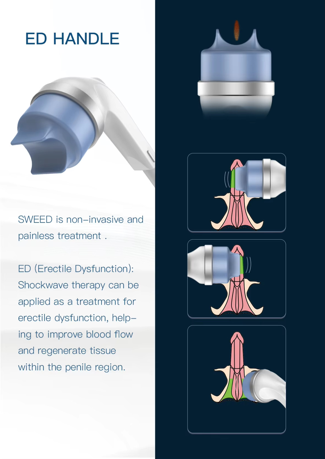 Focus Shockwave Eswt Focused Shock Wave Therapy Machine Pain Relief Physio
