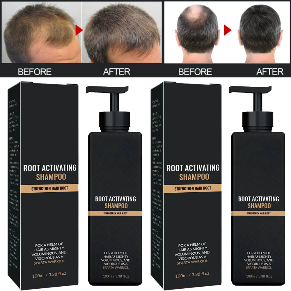 1-3PCS 200ml Root Activator Shampoo SPARTAN Hair Loss Shampoo Root Activator