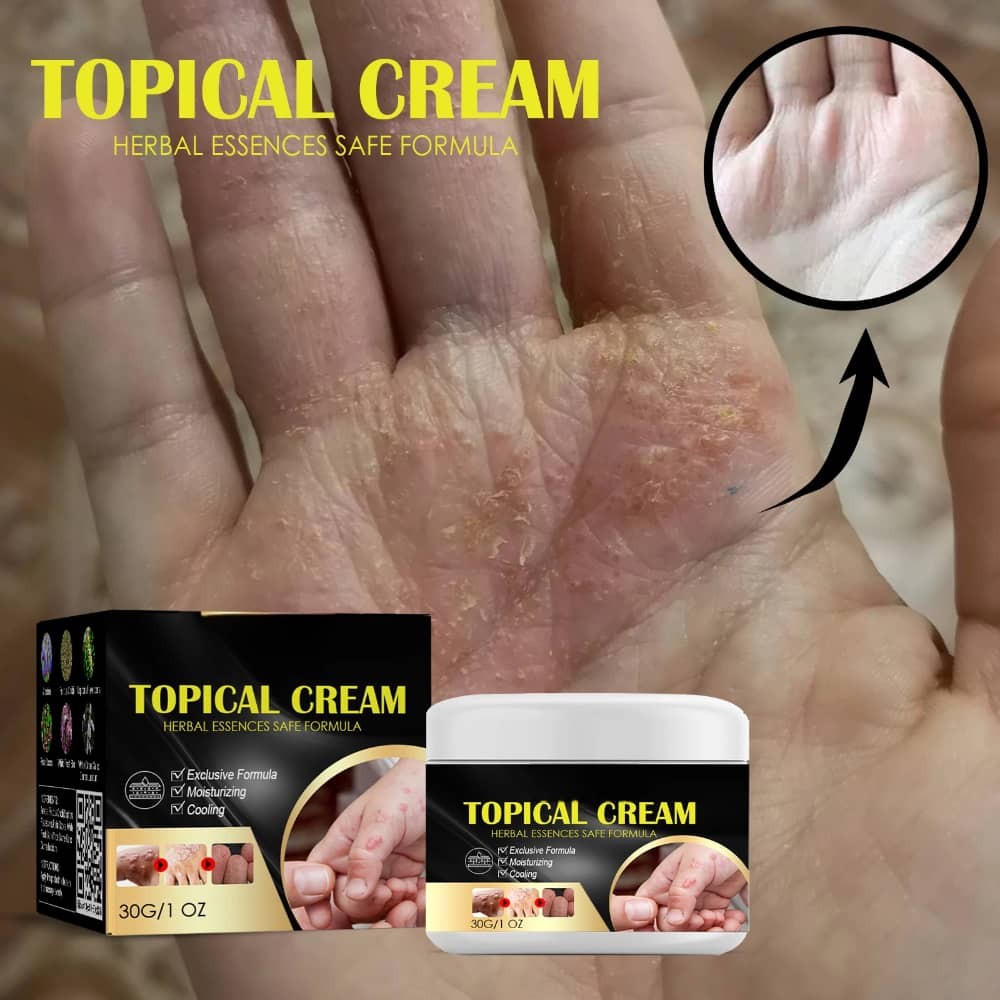 Herbal Topical Cream Soothing Dry Itching Skin Repairing Hand Foot Fungus Care