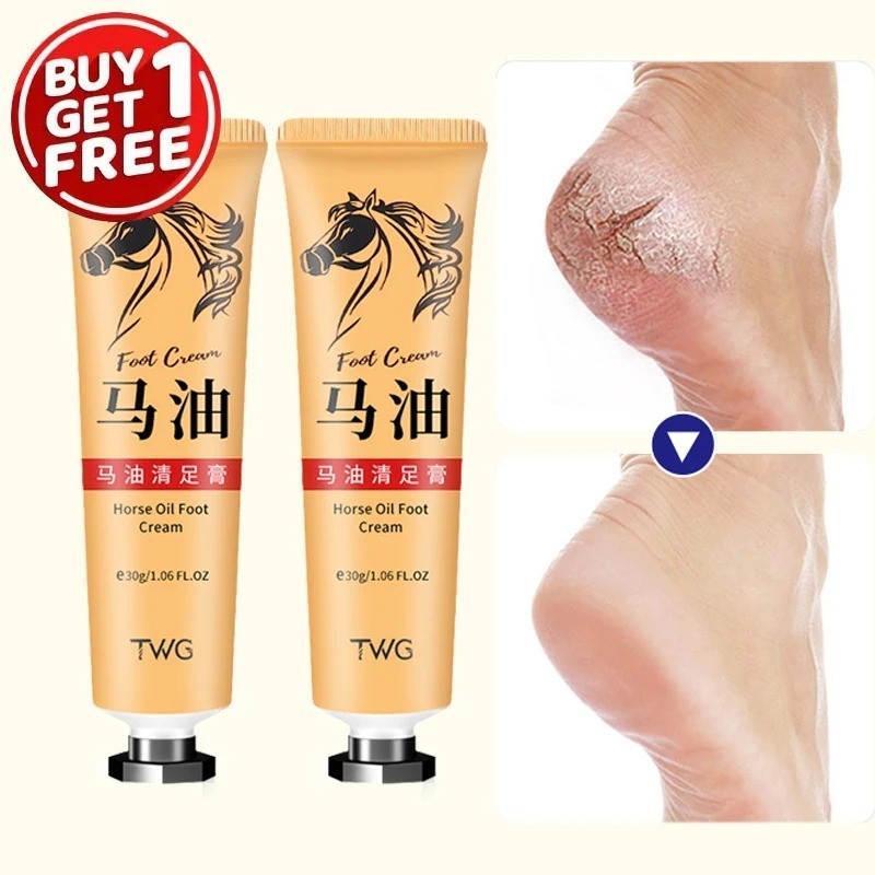 Ma You Qing Foot Cream Moisturizing Dry Skin Repair for Hands and Feet