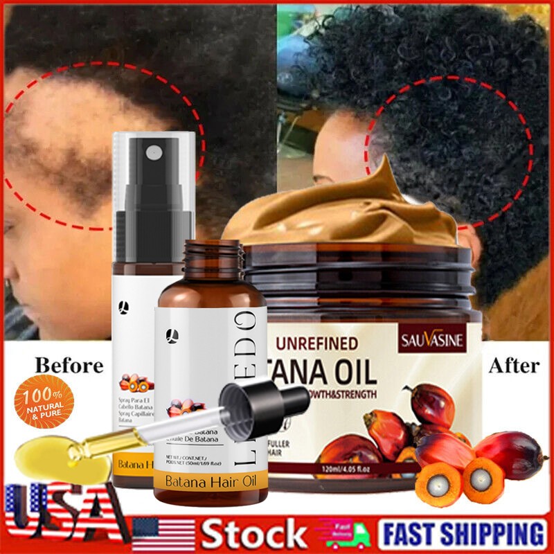 Batana Oil For Hair Growth Hair Loss Treatment Pure Natural Botana Oil Cream US