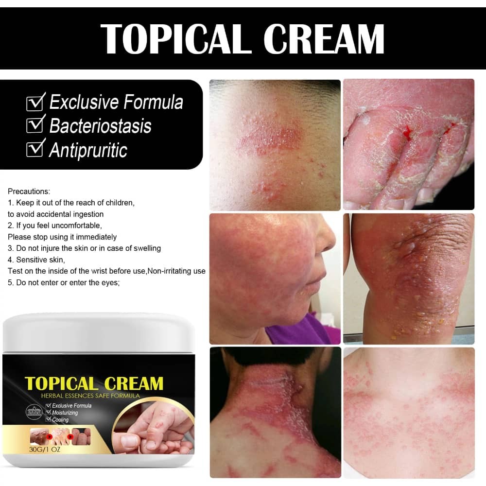 Herbal Topical Cream Soothing Dry Itching Skin Repairing Hand Foot Fungus Care
