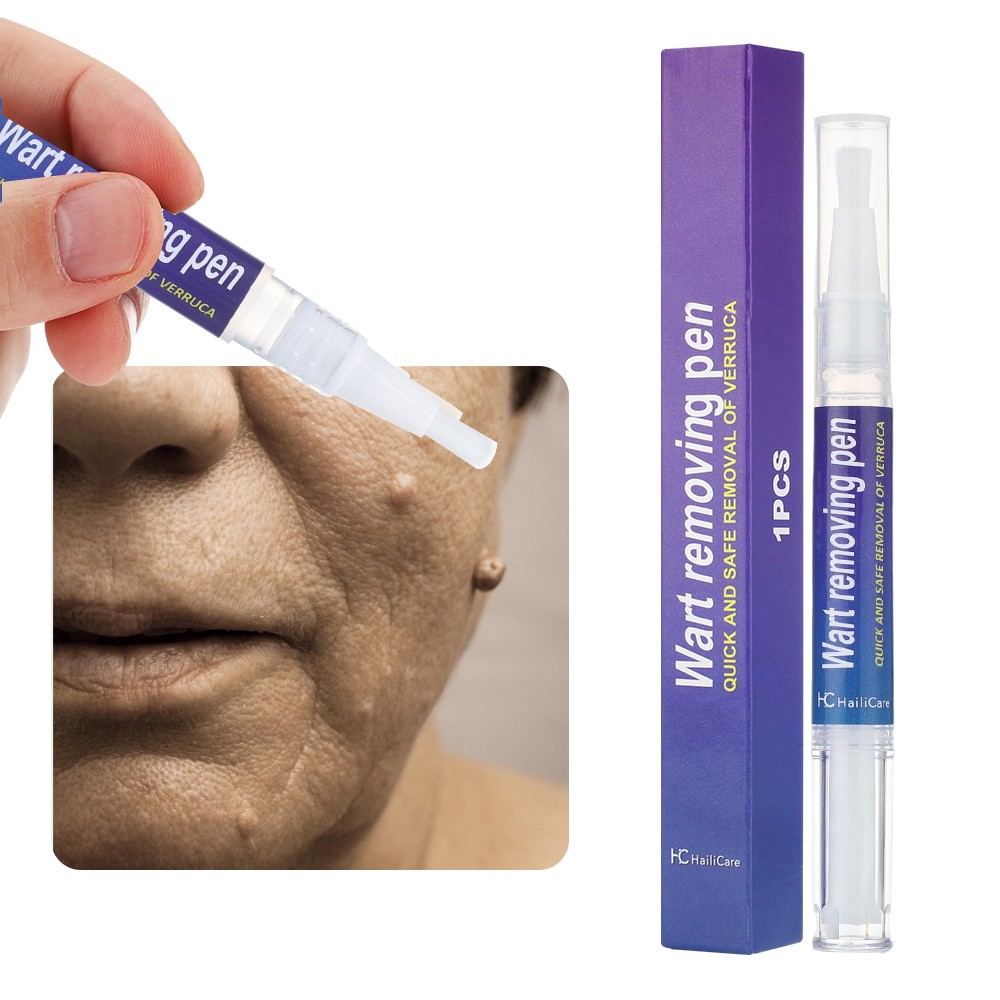 12 Hours Wart Remover Pen Skin Tag Mole Remover Eliminate Foot Corn Warts Unisex