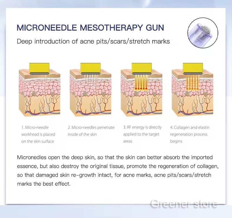 Skin Acne Stretch Remove Pen Mesotherapy Gun with 10Pcs 12Pin Cartridges Tips