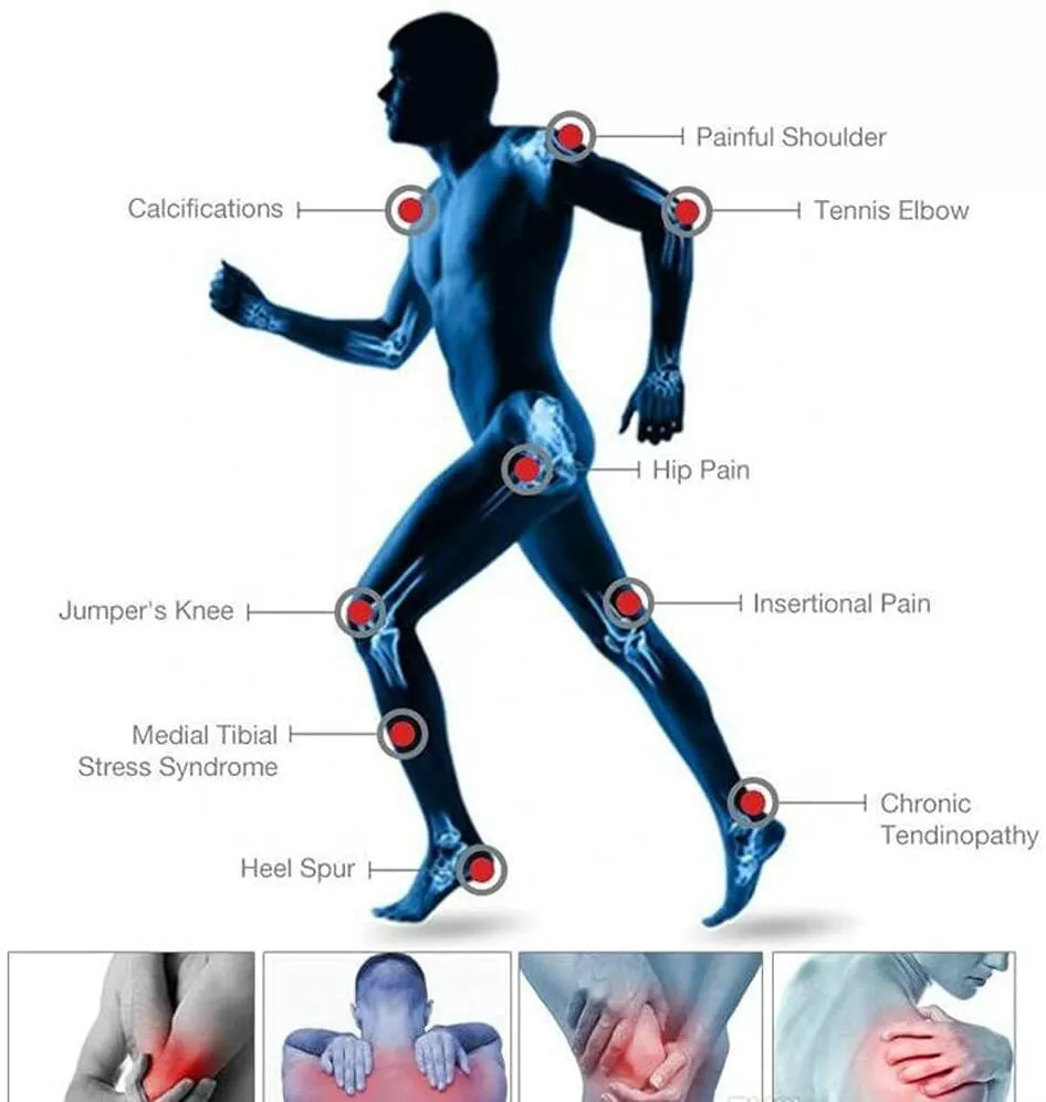 ED Teatment Focused Shockwave Therapy Machine for Pain Relief Body Massager