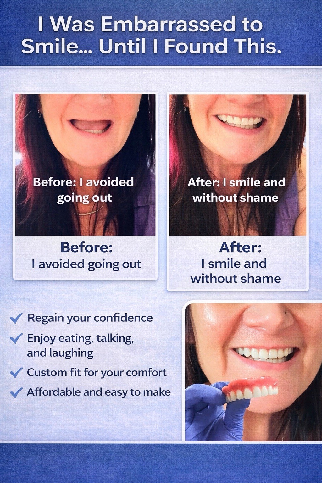 DIY Denture Kit Make Your Own Teeth At Home Complete Kit Full Partial A1 A2 A3